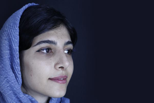 Miss Khazaie – RHINOPLASTY