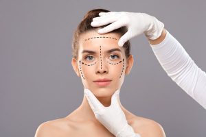 facelift
